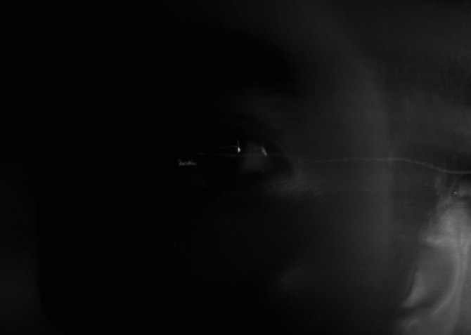 Eye open or closed during terrors